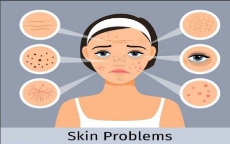 Adapalene powder factory Adapalene powder factory