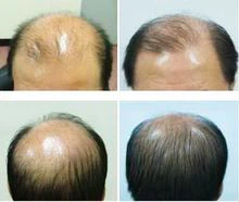 RU58841 suppliers